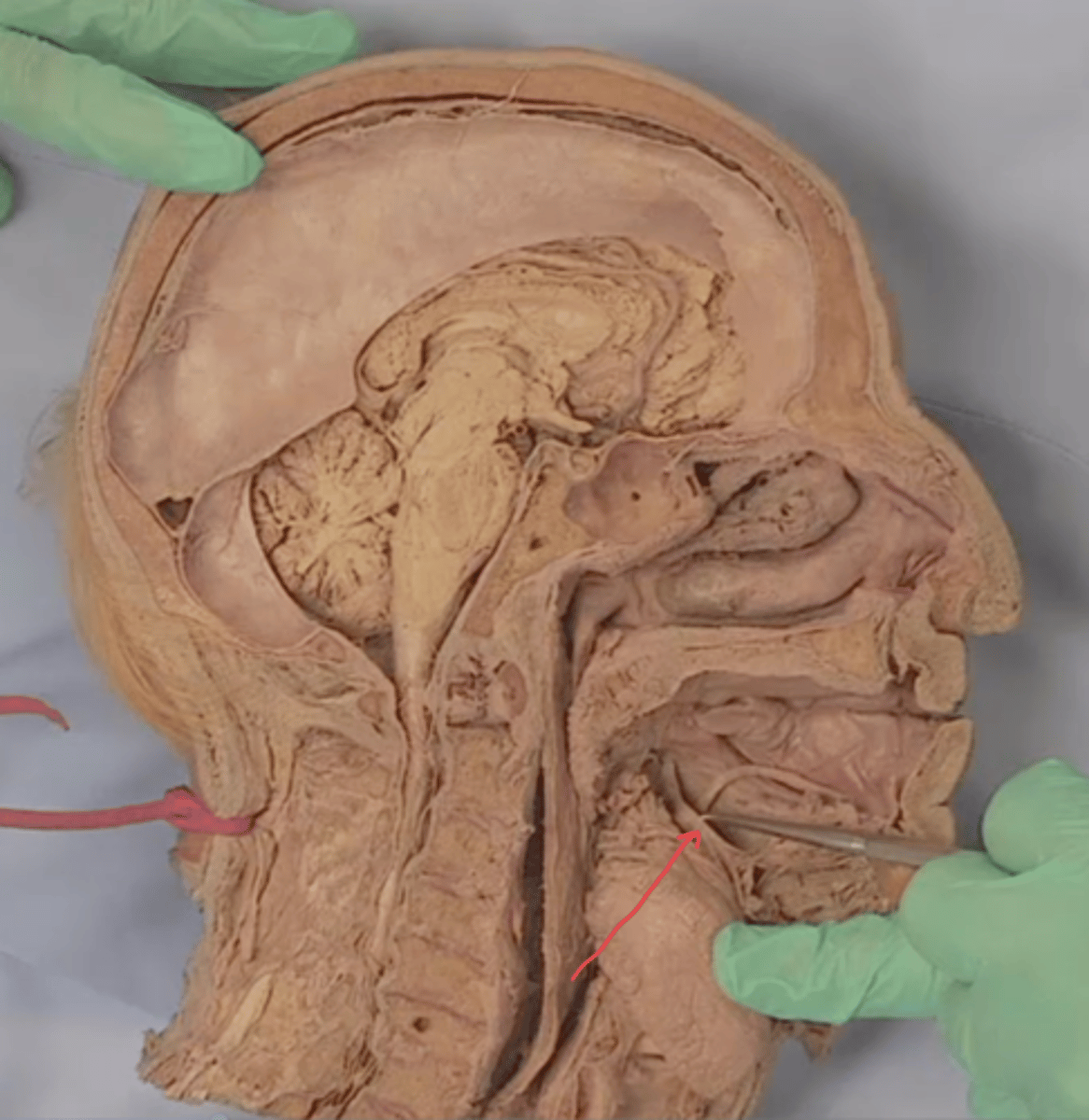 <p>identify this structure (tongue reflected)</p>