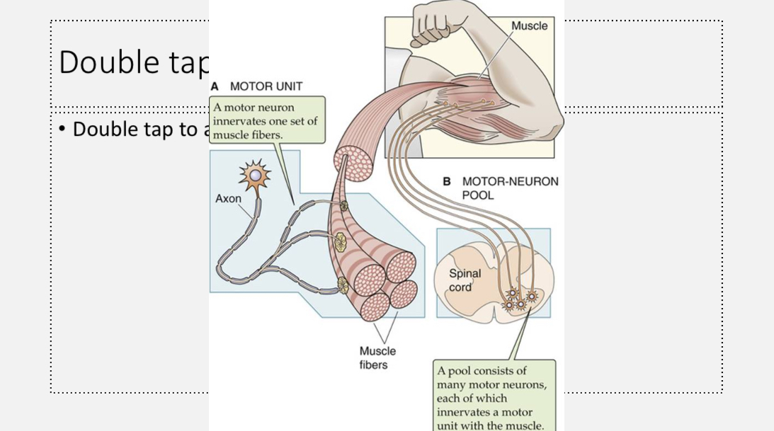 <p></p><ul><li><p><span><span>Muscle fibres all share the same basic sarcomere structure, but their functional behaviour changes because they express different protein isoforms. These isoforms alter how fast and how sensitively the contractile machinery works.</span></span></p></li></ul><p></p><p></p><p><span><span>Calcium sensitivity (thin filament regulation)</span></span></p><ul><li><p><span><span>Troponin and tropomyosin exist in different isoforms.</span></span></p></li><li><p><span><span>Different isoforms change how easily the thin filament responds to calcium.</span></span></p></li><li><p><span><span>Higher calcium sensitivity means force develops at lower calcium levels.</span></span></p></li><li><p><span><span>This tuning affects how smoothly and how long a fibre can contract.</span></span></p></li></ul><p></p><p></p><p><span><span>ATP hydrolysis rate (thick filament motor speed)</span></span></p><ul><li><p><span><span>Myosin heavy chain isoforms differ in ATPase activity.</span></span></p></li><li><p><span><span>ATPase rate determines cross-bridge cycling speed.</span></span></p></li><li><p><span><span>Faster ATP hydrolysis produces faster contraction but quicker fatigue.</span></span></p></li><li><p><span><span>Slower ATP hydrolysis produces slower contraction but greater endurance.</span></span></p></li></ul><p></p><p></p><p></p><ul><li><p><span><span>Slow-twitch fibres (Type I)</span></span></p><ul><li><p><span><span>Express type I myosin heavy chain</span></span></p></li><li><p><span><span>Have low ATPase activity</span></span></p></li><li><p><span><span>Show slow cross-bridge cycling</span></span></p></li><li><p><span><span>Are specialised for sustained, fatigue-resistant contractions</span></span></p></li></ul></li></ul><p></p><p></p><p></p><ul><li><p><span><span>Fast-twitch fibres (Type II)</span></span></p><ul><li><p><span><span>Express type II myosin heavy chain</span></span></p></li><li><p><span><span>Have high ATPase activity</span></span></p></li><li><p><span><span>Show rapid cross-bridge cycling</span></span></p></li><li><p><span><span>Are specialised for fast, powerful contractions</span></span></p></li></ul></li></ul><p></p><p></p><ul><li><p><span><span>Muscle fibre type composition can be different in different muscles and can adapt over time to the needs of the body</span></span></p></li></ul><p></p><p></p>