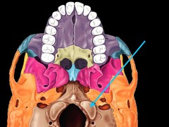 <p>Rounded projections lateral to the foramen magnum that articulate with the first cervical vertebra (atlas)</p>