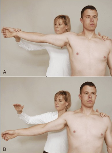 <p>Drop Arm Test</p>