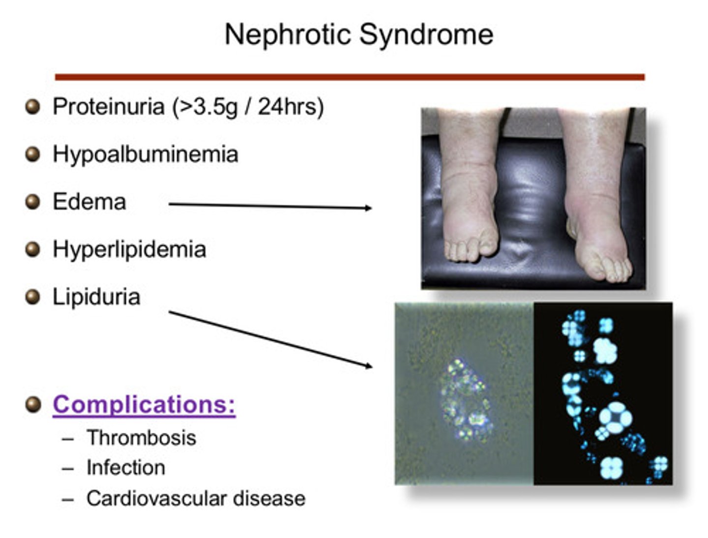 <p>1) thrombosis</p><p>2) infection</p><p>3) CV disease</p>