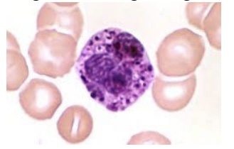 <p><span style="font-family: Helvetica; font-size: 12px;">Which of the following is TRUE regarding these cells?</span></p><p><span style="font-family: Helvetica; font-size: 12px;">a. Their granules contain anti-histamine</span></p><p><span style="font-family: Helvetica; font-size: 12px;">b. They are identified as eosinophils</span></p><p><span style="font-family: Helvetica; font-size: 12px;">c. They fight parasitic infections</span></p><p><span style="font-family: Helvetica; font-size: 12px;">d. Their normal peripheral blood range is 0-1%</span></p>