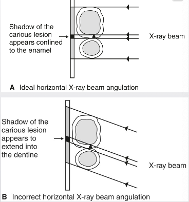 <p>What are some 2D angulation limitations</p>