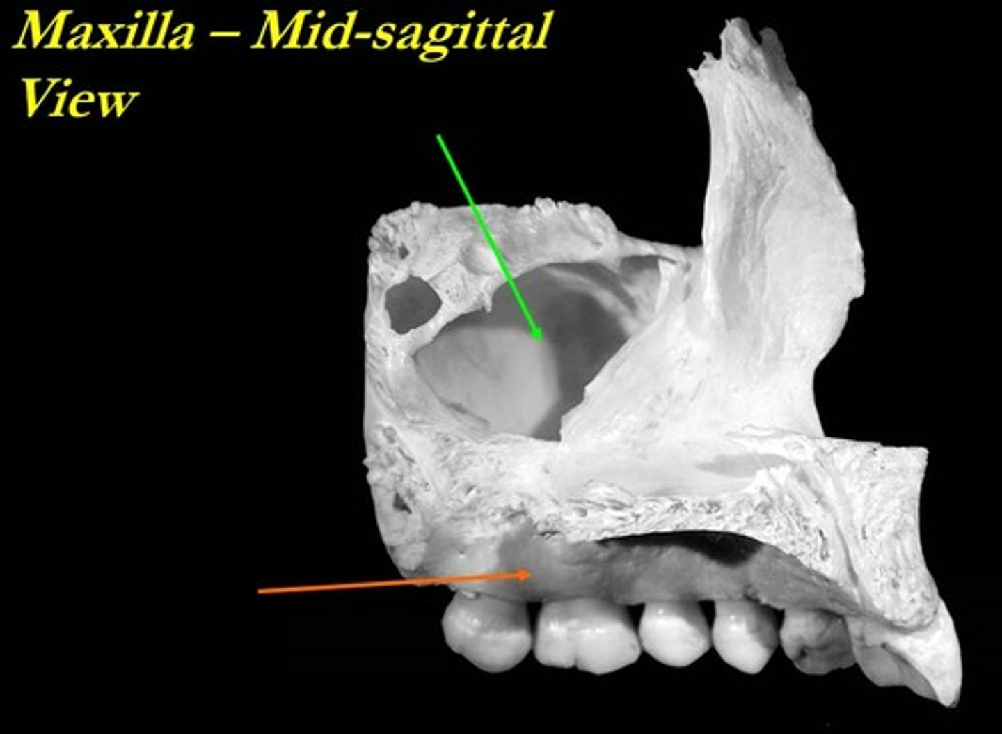 <p>What is the orange arrow pointing to?</p>