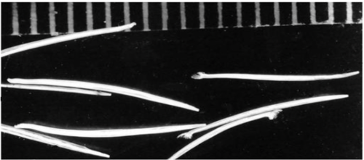 <p>What is this parasite? What characteristic/s did you use to identify it? (scale in mm)</p>