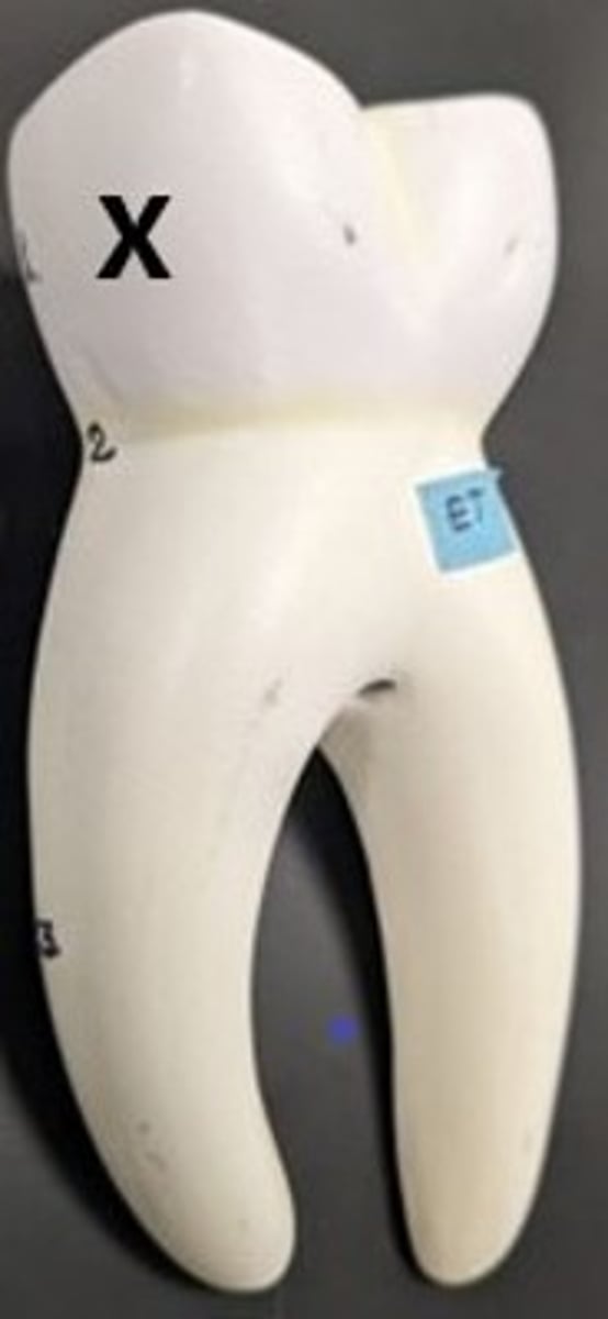 <p>ID the External Tooth Region</p>