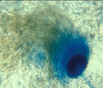 <p>conidia = cinnamon, buff, brown, orange brown</p><p>BISERIATE</p><p>conidia form long chains</p><p>fan-like</p>