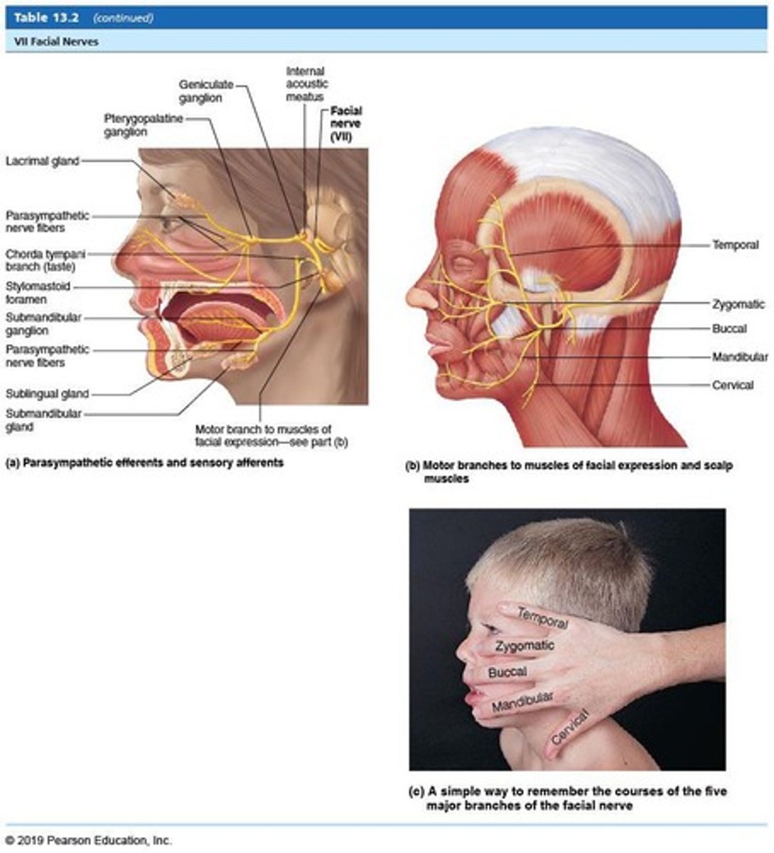 <p>Facial nerve.</p>