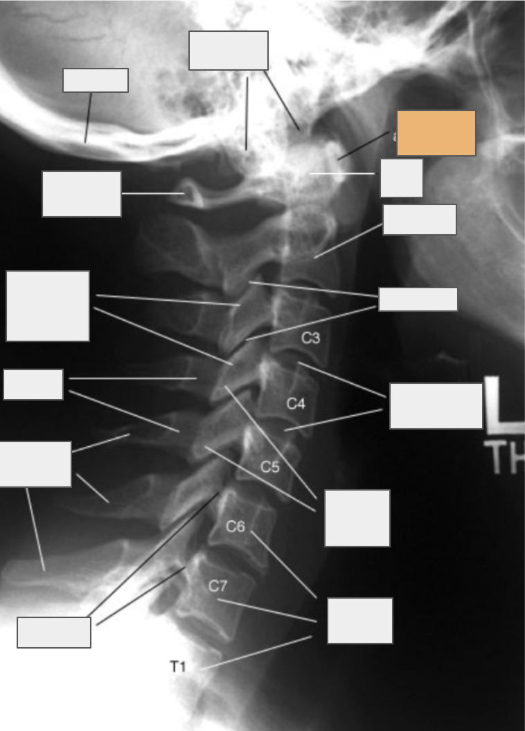 <p>What structure of the spine does the box highlighted in orange reference to?</p>
