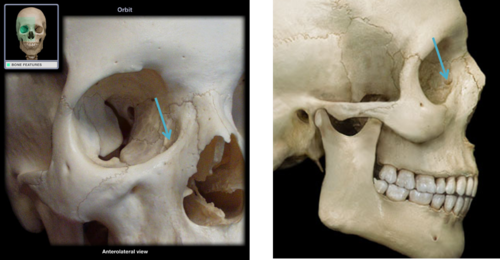 bony canal within the maxilla that is continuous superiorly with the fossa for the lacrimal sac; lies below the orbital floor and leads inferior into the inferior meatus of the nasal cavity, which contains the nasolacrimal duct

lies anterior-medial on the floor