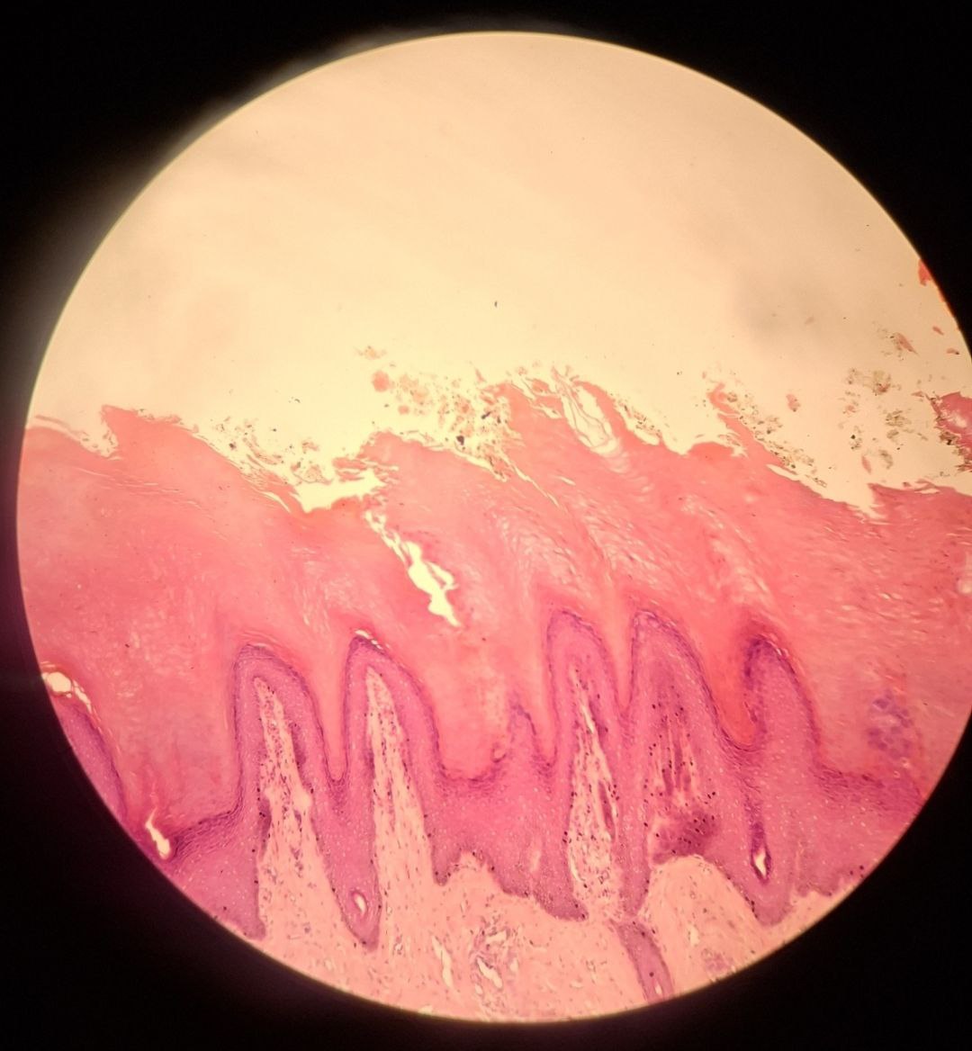 <p>Identify the tissue and mention one site</p>