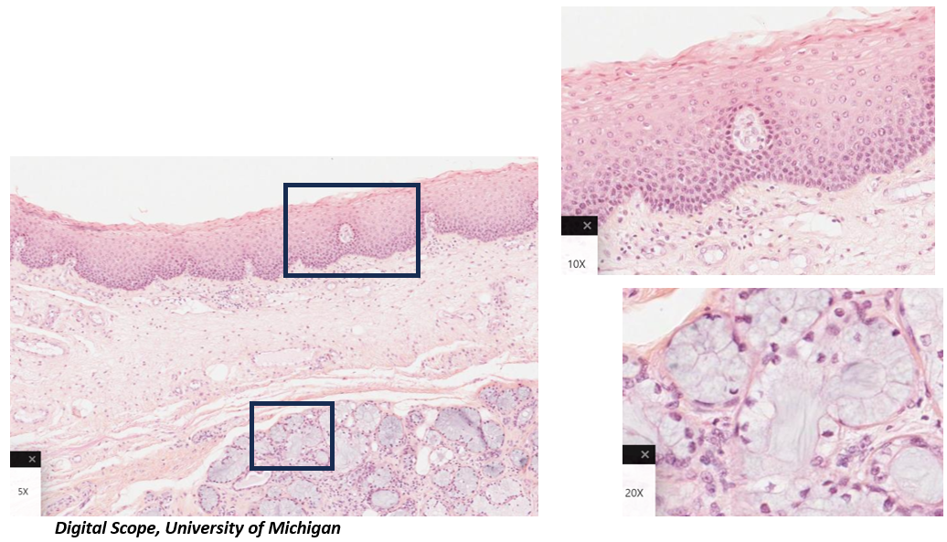 <p>Which mucosa is present in this image? How do you know?</p>