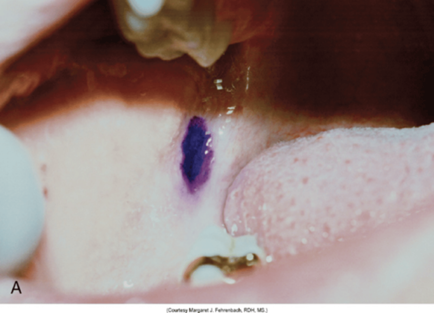 <p>tear drop</p>
