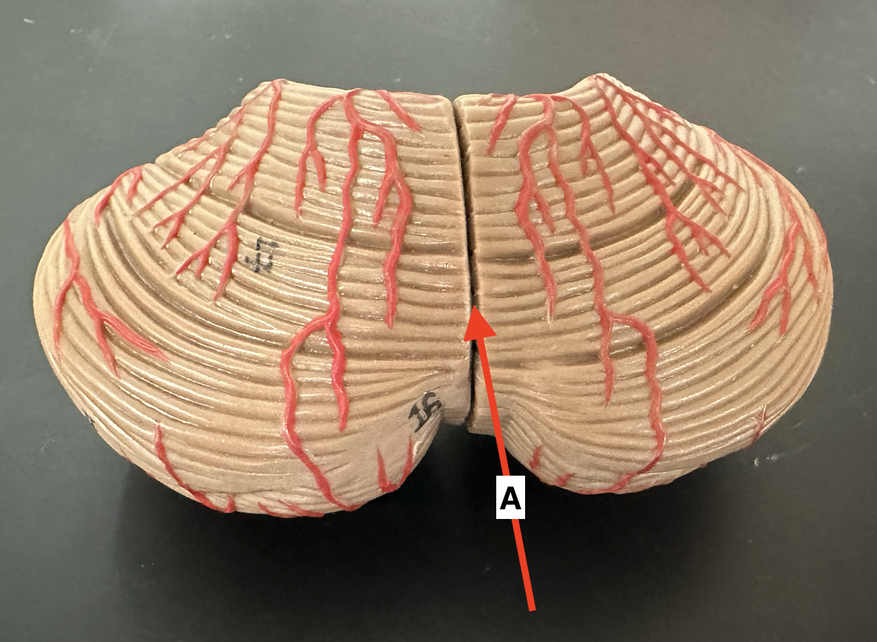 <p>Name point A.</p>