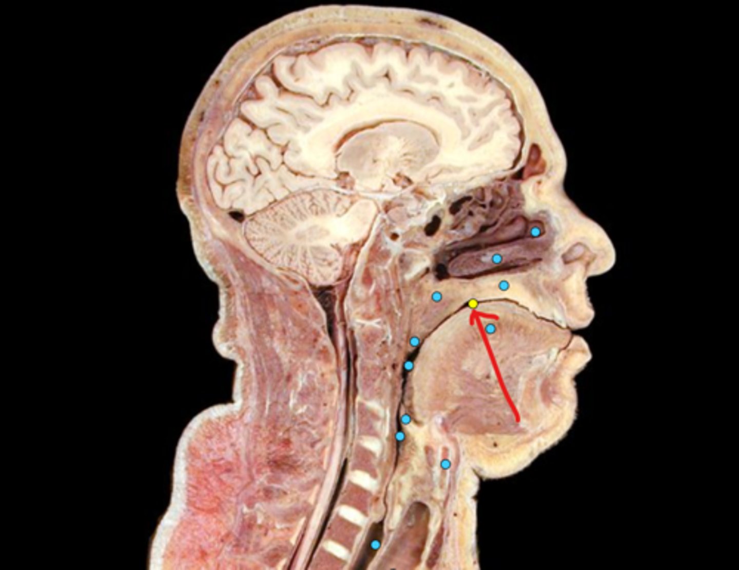 knowt flashcard image