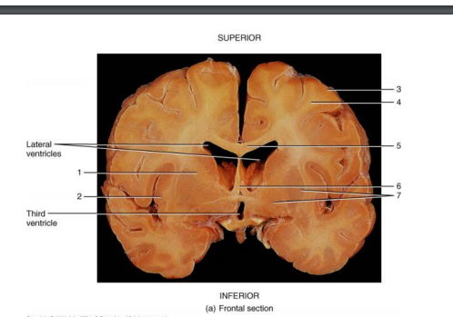 <p>(7) basal ganglia/nucleus function</p>
