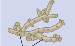 <p>What is this called?</p>