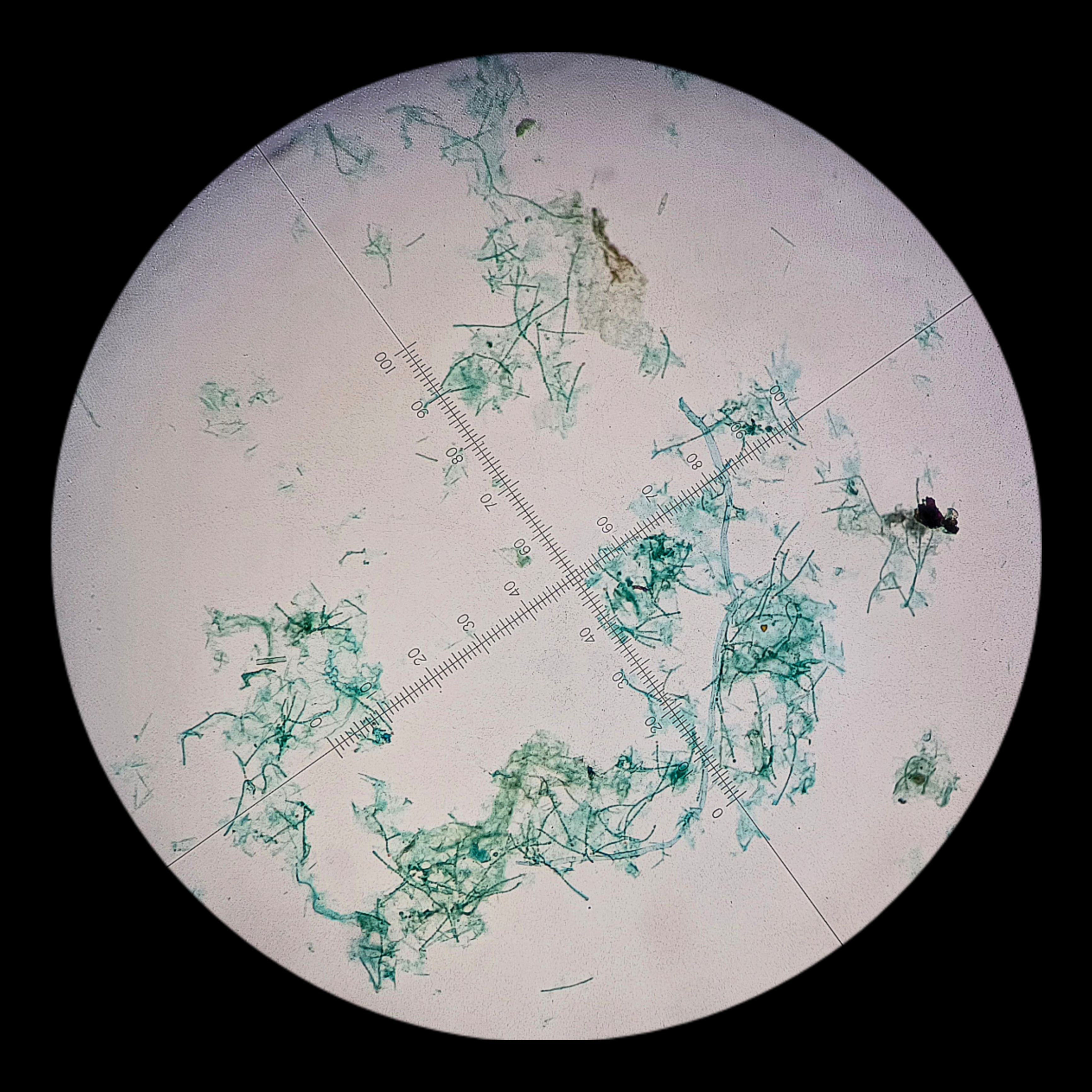 <p><strong><em>Anabaena</em></strong></p><p><strong>Phylum: </strong>?</p>