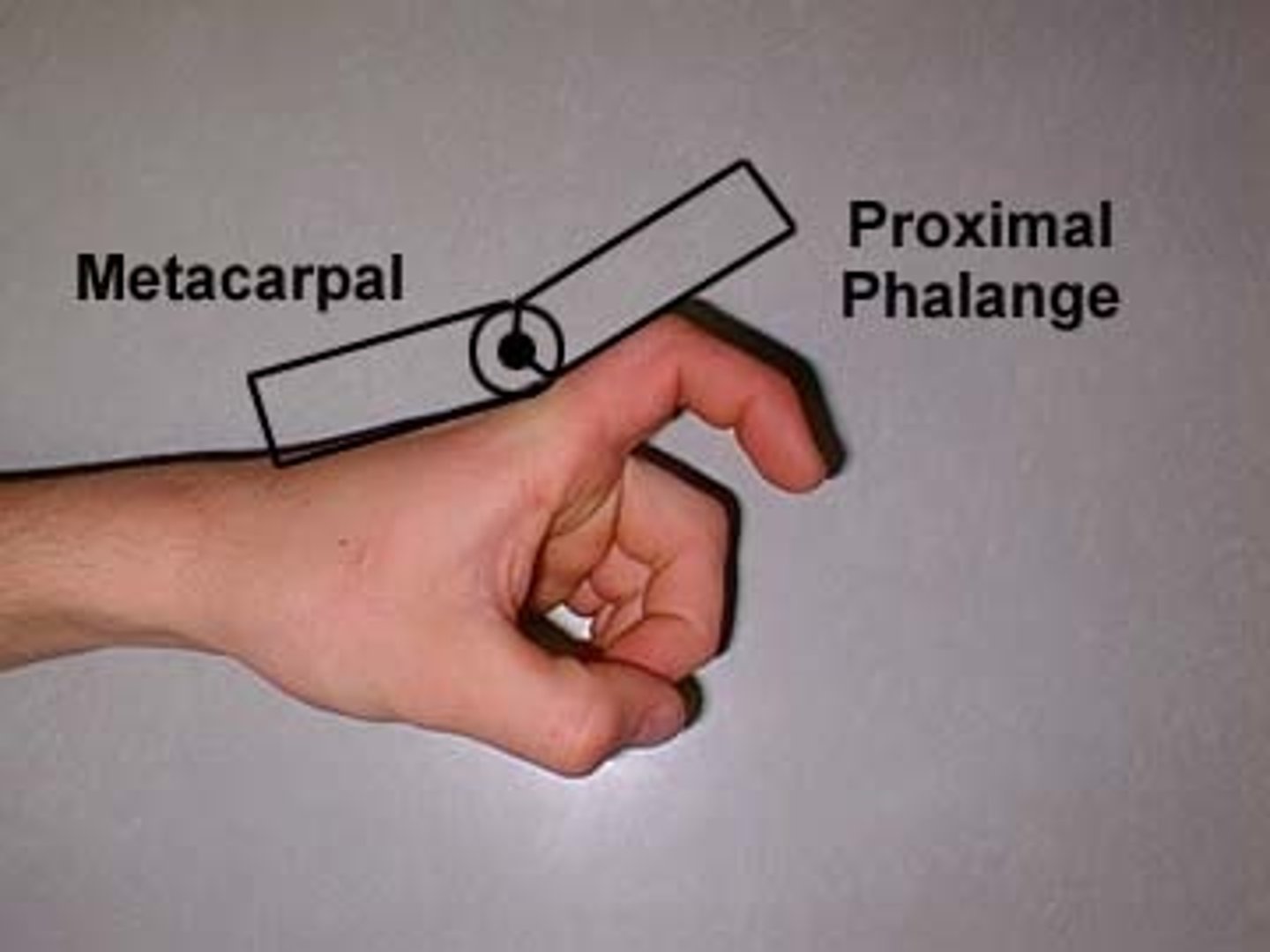<p>fulcrum: dorsal MCP joint<br>proximal: dorsal midline of metacarpal<br>distal: dorsal midline of proximal phalanx<br><br>* medial/ulnar side of hand resting on table<br>* normal value = 45</p>