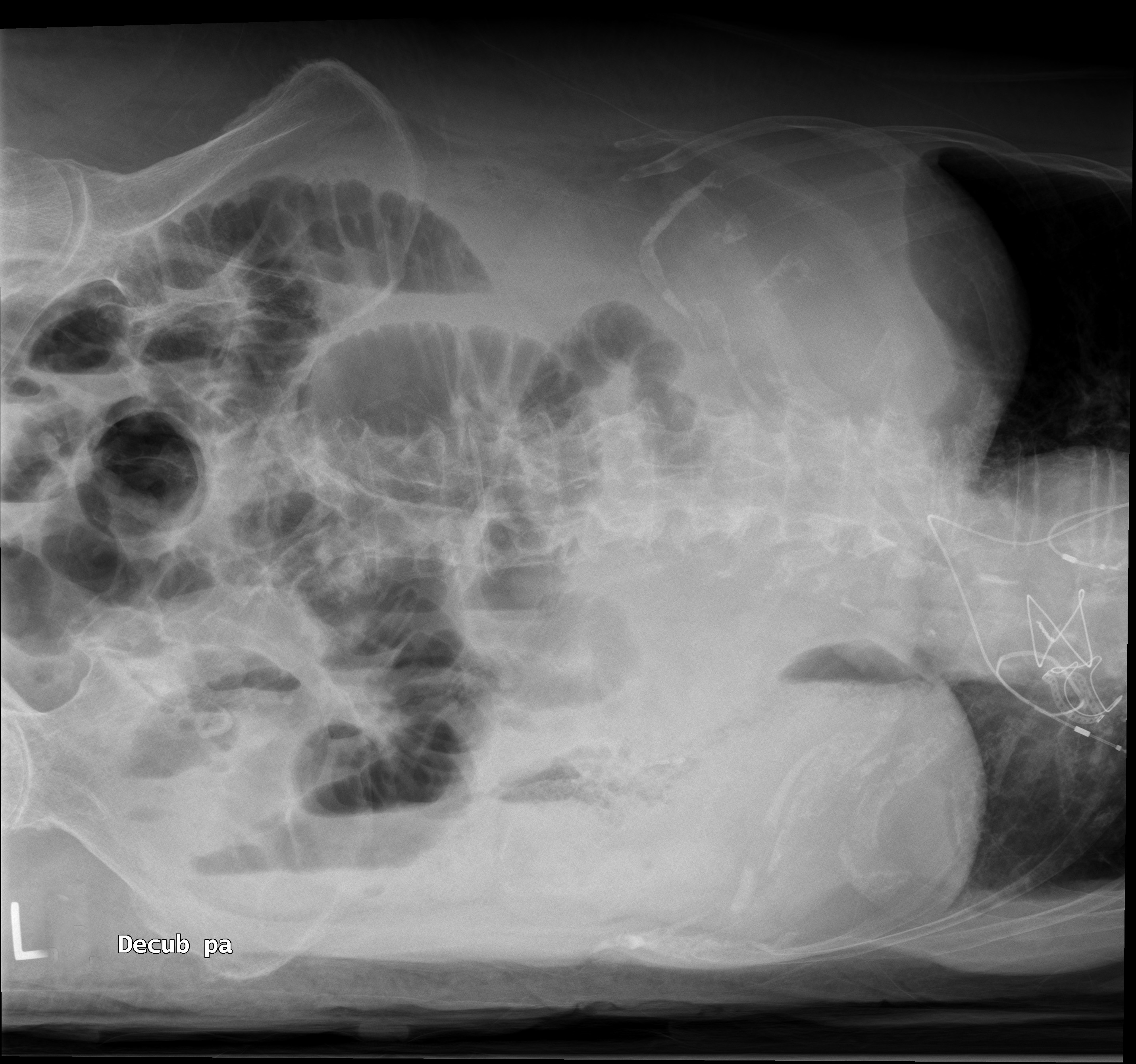 <p>When the patient cannot stand for an erect image; to detect free air.</p>