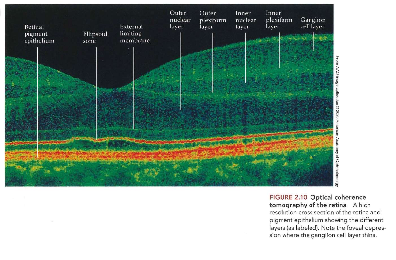 <ul><li><p>netvlies bestaat uit meerdere lagen</p><ul><li><p>± helft van dikte van een creditcard</p></li><li><p>laag pigmentepitheel achter laatste laag van retina</p></li></ul></li><li><p>optical coherence tomography (OCT)</p><ul><li><p>= niet-invasieve beeldvormingstechniek die gebruikt maakt van licht</p></li><li><p>laat oogarts toe om lagen van netvlies in dwarsdoorsnede te bekijken</p></li></ul></li></ul><p></p>