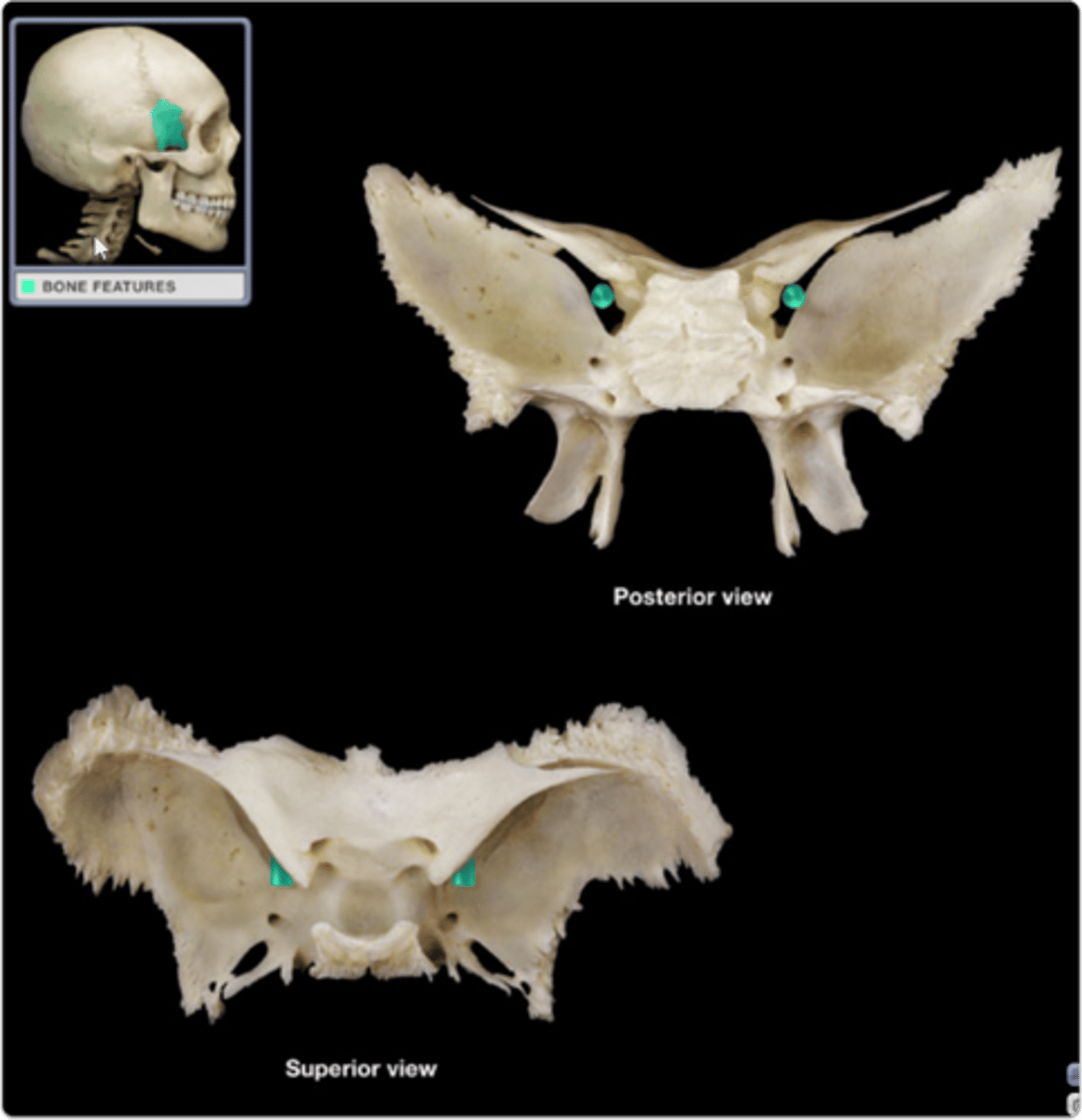 <p><em>identify the structure:</em></p>