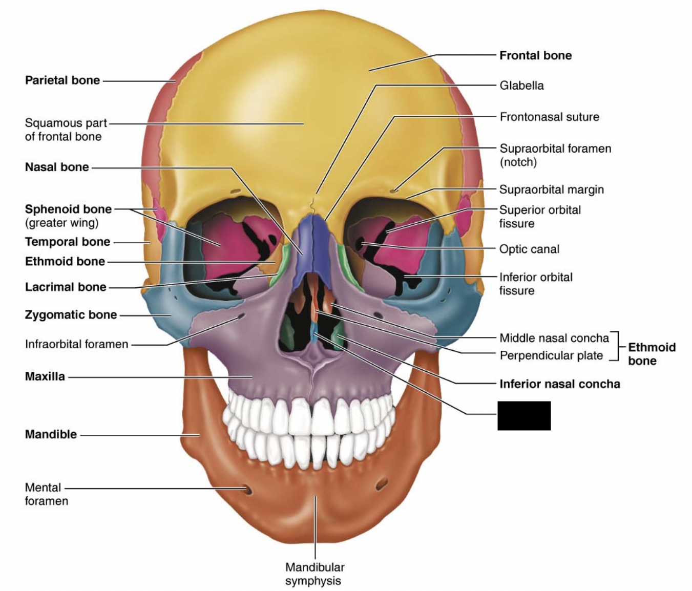 What facial bones is this?