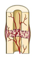 New capillaries begin to form into the clotted blood in the damaged area. Connective tissues cells form a mass of repair tissue called a fibrocartilage callus. This callus contains some cartilage, some bone, and collagen fibers. The combined mass closes the gap between the broken bones.