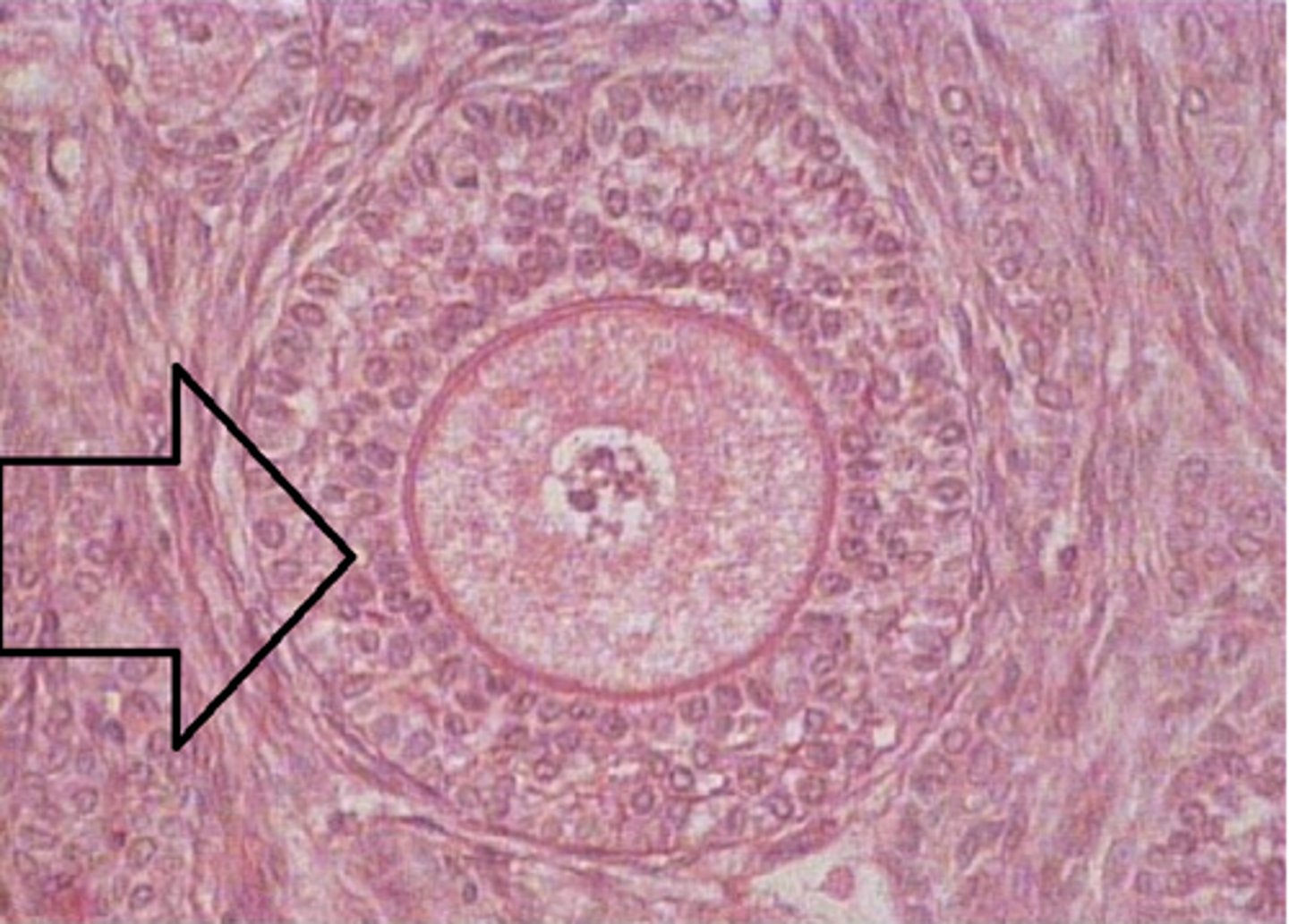 <p>Identify the follicle</p>