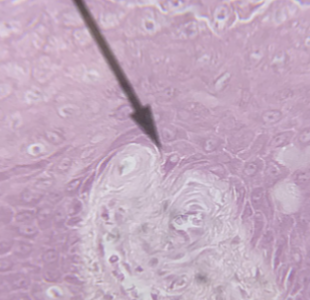 <p>what type of tissue is this </p>
