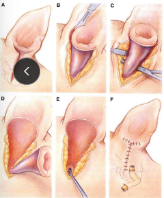 <p><span>Ear Surgical procedures</span></p>