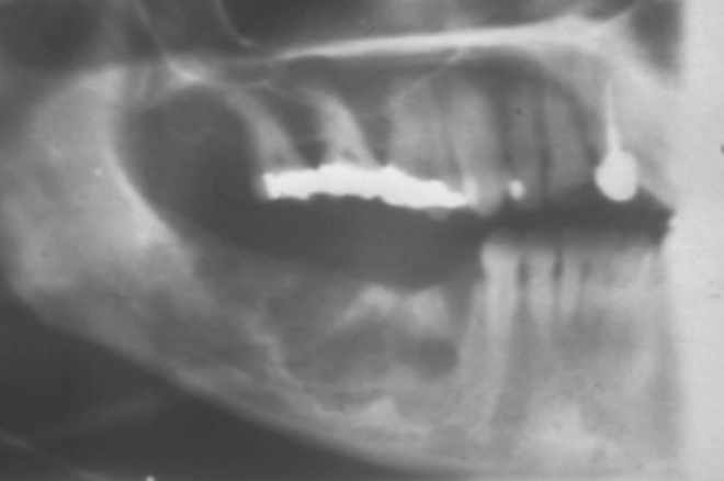 <p>how would you describe the BORDERs of this lesion </p>