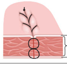 <p>Strong closure; made from beneath; tighten after each stitch.</p>