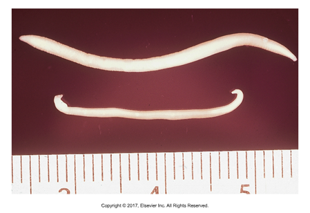 <p>Stomach worms - "Bladder wing"</p><ul><li><p>Found: Worldwide​</p></li><li><p>Affects: Cats and dogs​</p></li><li><p>Thick-shelled larvated egg; Creamy white, 1.3-4.8 cm adults; Ovoviviparous​</p></li><li><p>Found on fecal flotation if solution has SG &gt; 1.25 (most clinics use 1.2-1.25)​</p></li><li><p>Can be seen in vomit; often mistaken for ascarids if seen grossly — must examine eggs​</p></li><li><p>Stomach or small intestine; suck blood from mucosal surface​</p></li><li><p>Cause of infection: Ingestion of eggs​</p></li><li><p>Symptoms: Vomiting, anorexia, dark stool​</p></li><li><p>Prepatent period: 56-83 days</p></li></ul><p></p>