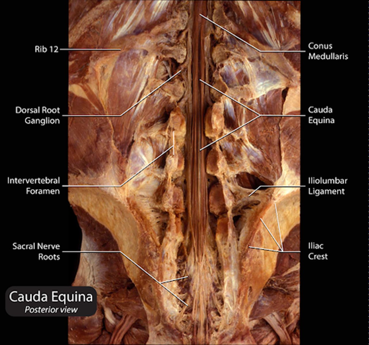 <p>bulb coming off spinal cord</p>