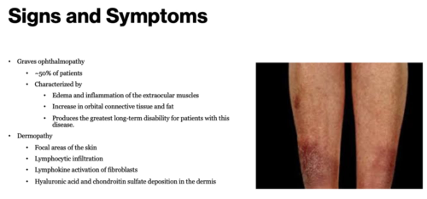 <p>Graves ophthalmopathy</p>