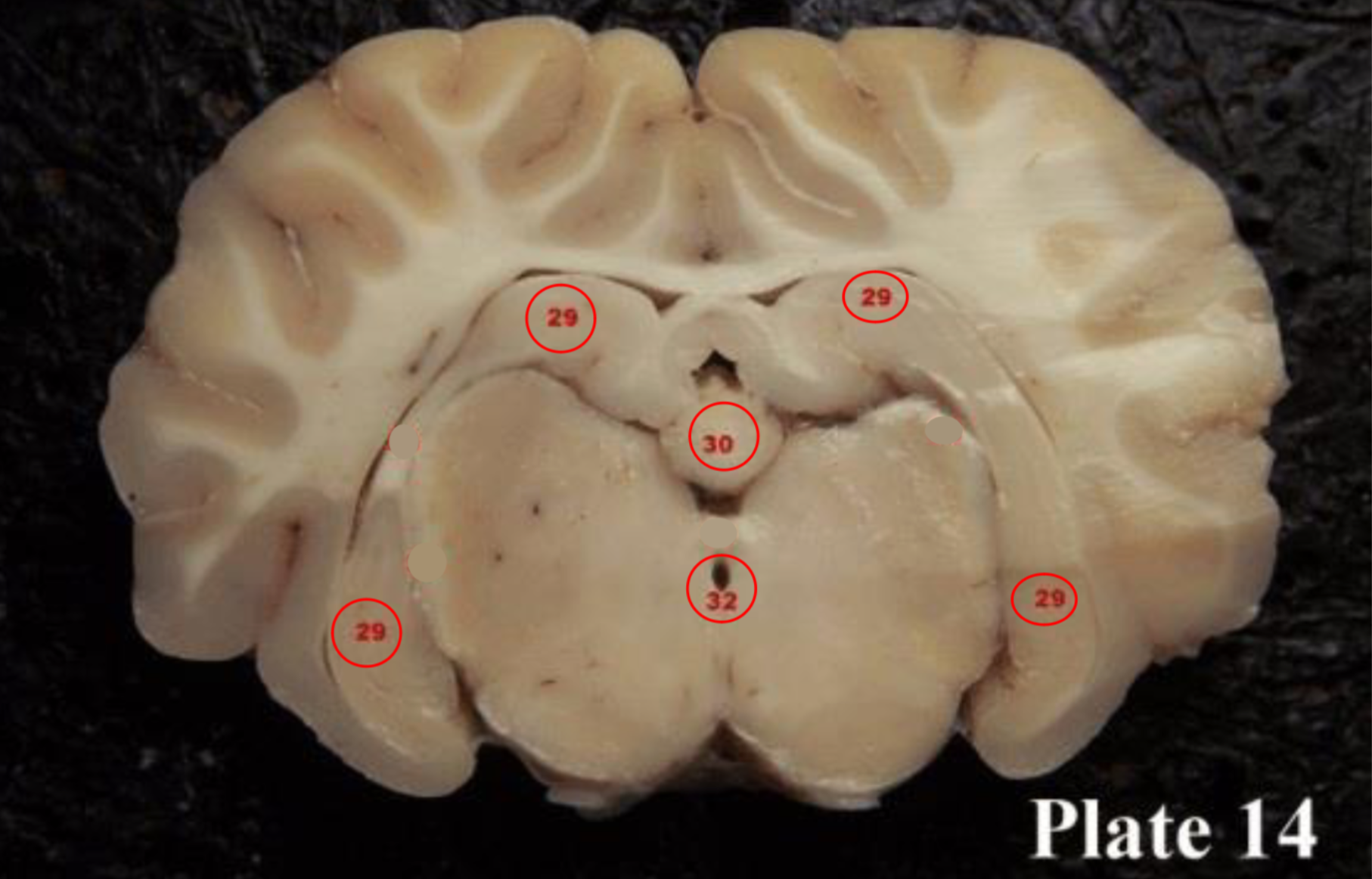 <p>Pineal gland</p>
