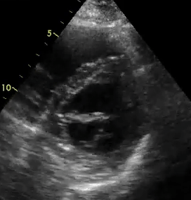 <p>1. What view is this?</p><p>2. What is wrong with this image? </p><p>3. What would we do to correct this image? Be specific, how would we manipulate the transducer?</p>