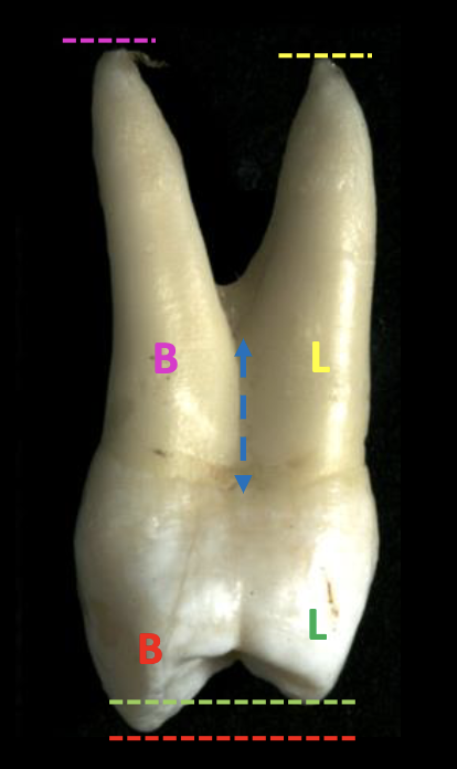 <p>2 (buccal and lingual)</p>