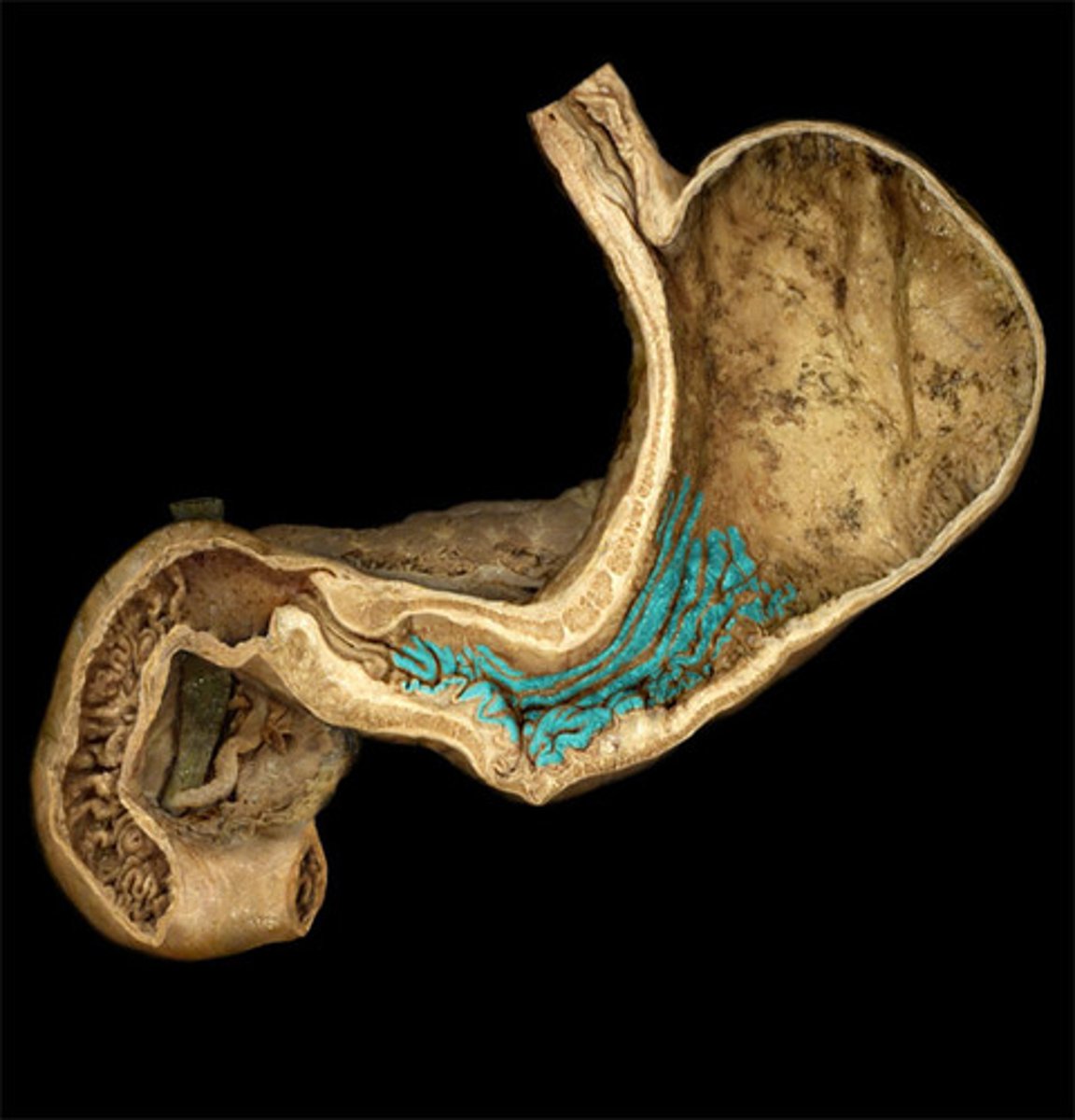 <p>internal structure. Inside the stomach.</p>