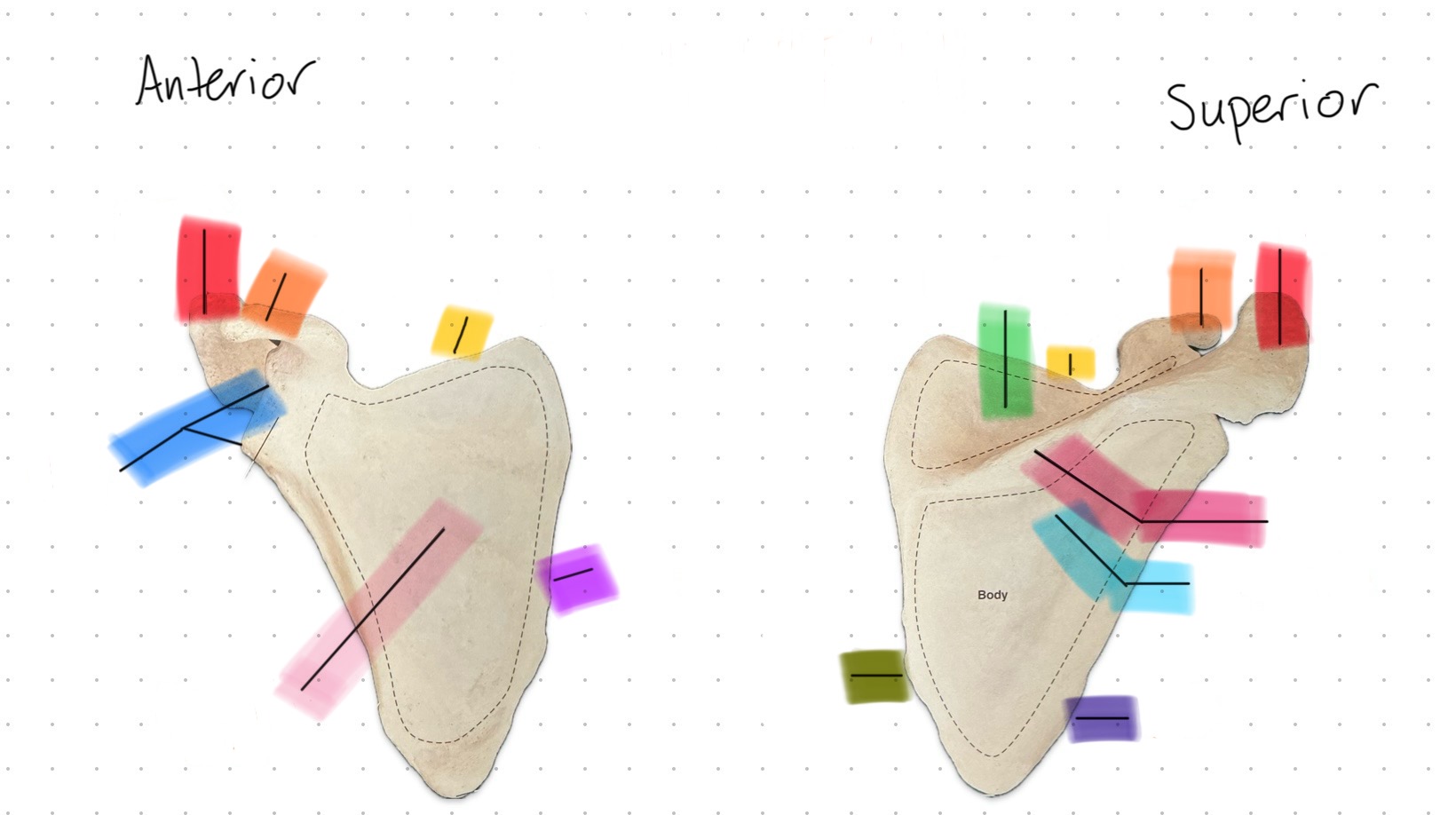 <p>What is the pink part?</p>