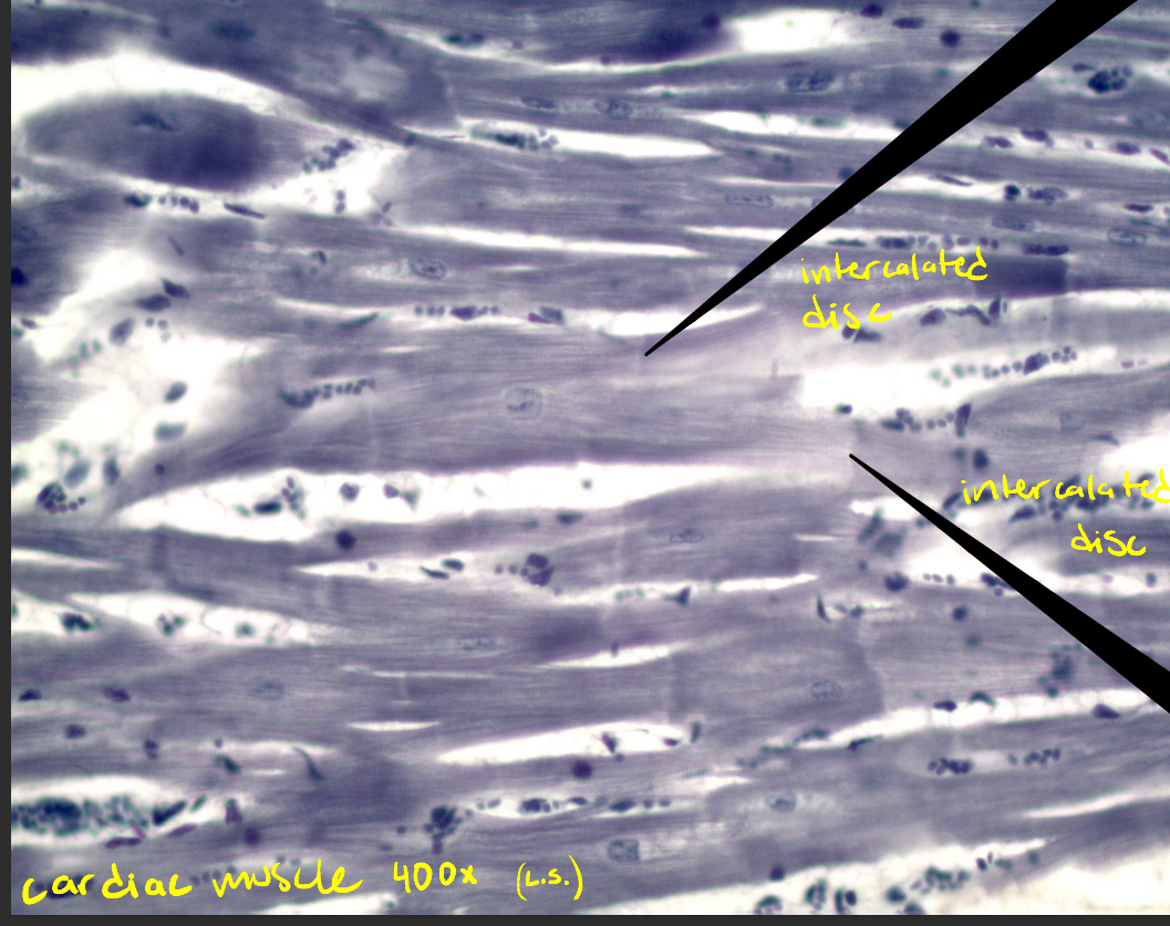 <p>Cardiac muscle </p>
