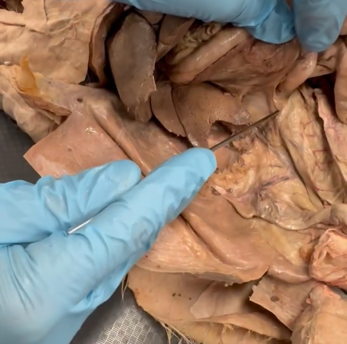 <p>What is being stretched by pointer</p>