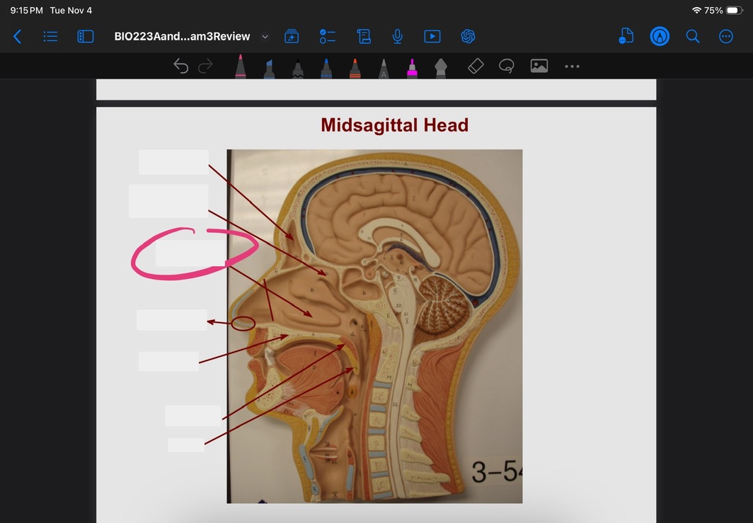 <p>What is this?</p>