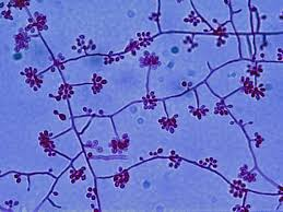 <p>MISSISSIPPI AND MISSOURI RIVER VALLEYS</p><p>FARMERS AND FLORISTS</p><p>CUTANEOUS LESIONS</p><p></p>