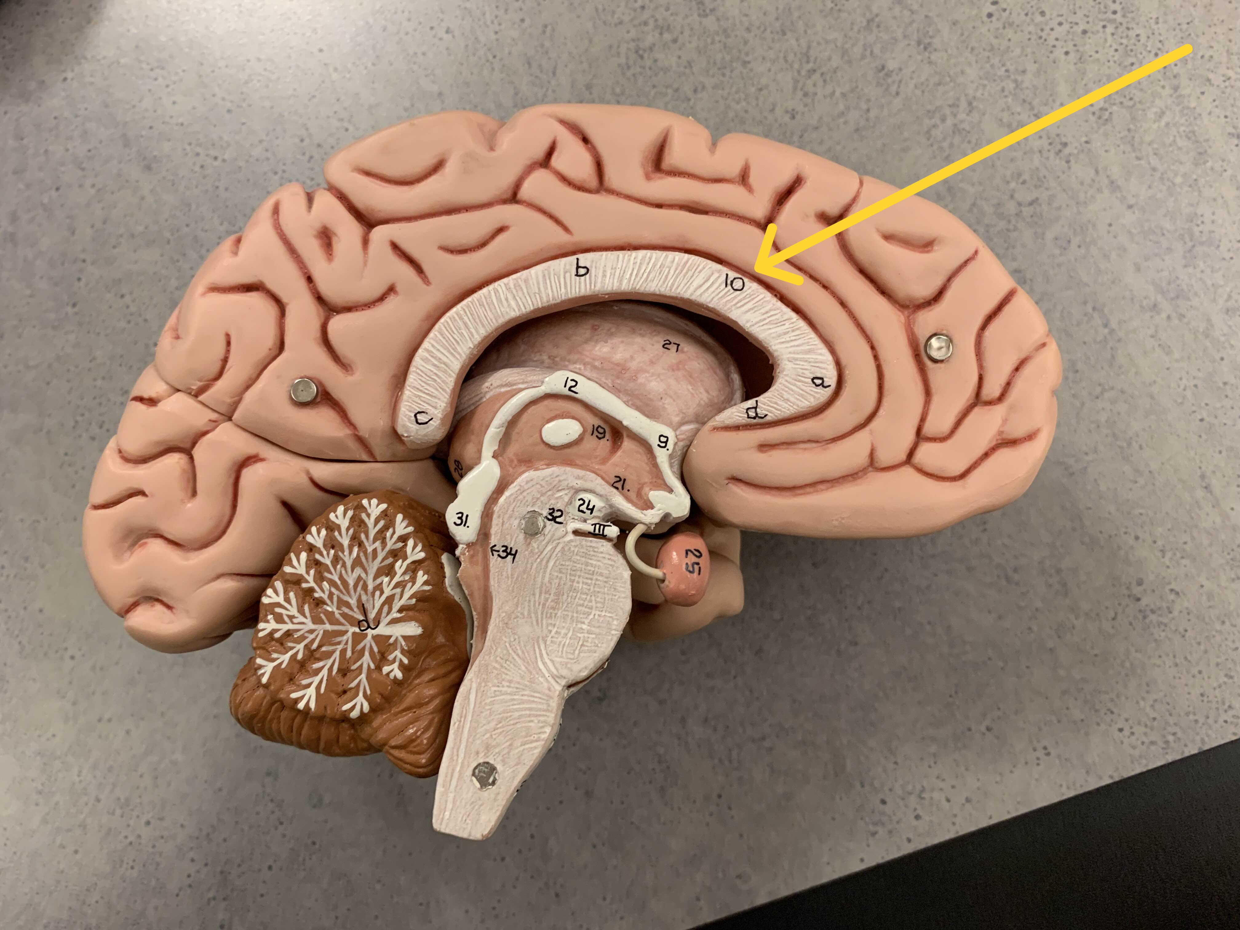 <p>Which&nbsp;part of the brain is:</p><ul><li><p>Thick band of nerve fiber connects both cerebral hemispheres</p></li><li><p>Dome over top of lateral ventricle, top half of C</p></li></ul><p></p>