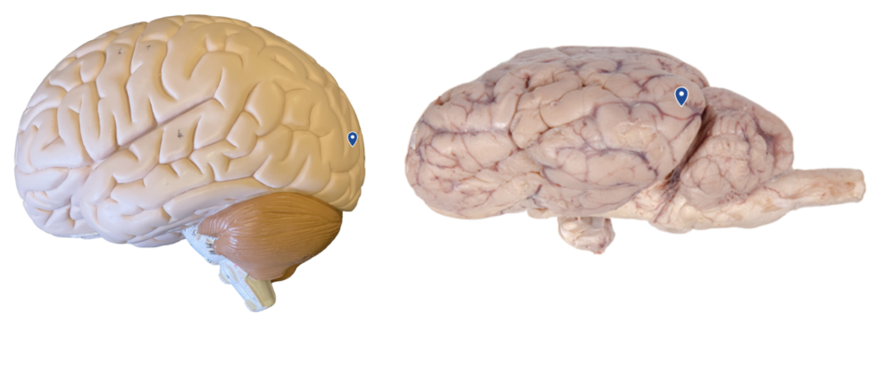 <p>What lobe is the arrow pointing to?</p>