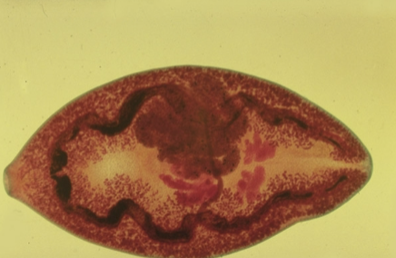 <p>Paragonimus westermani </p>