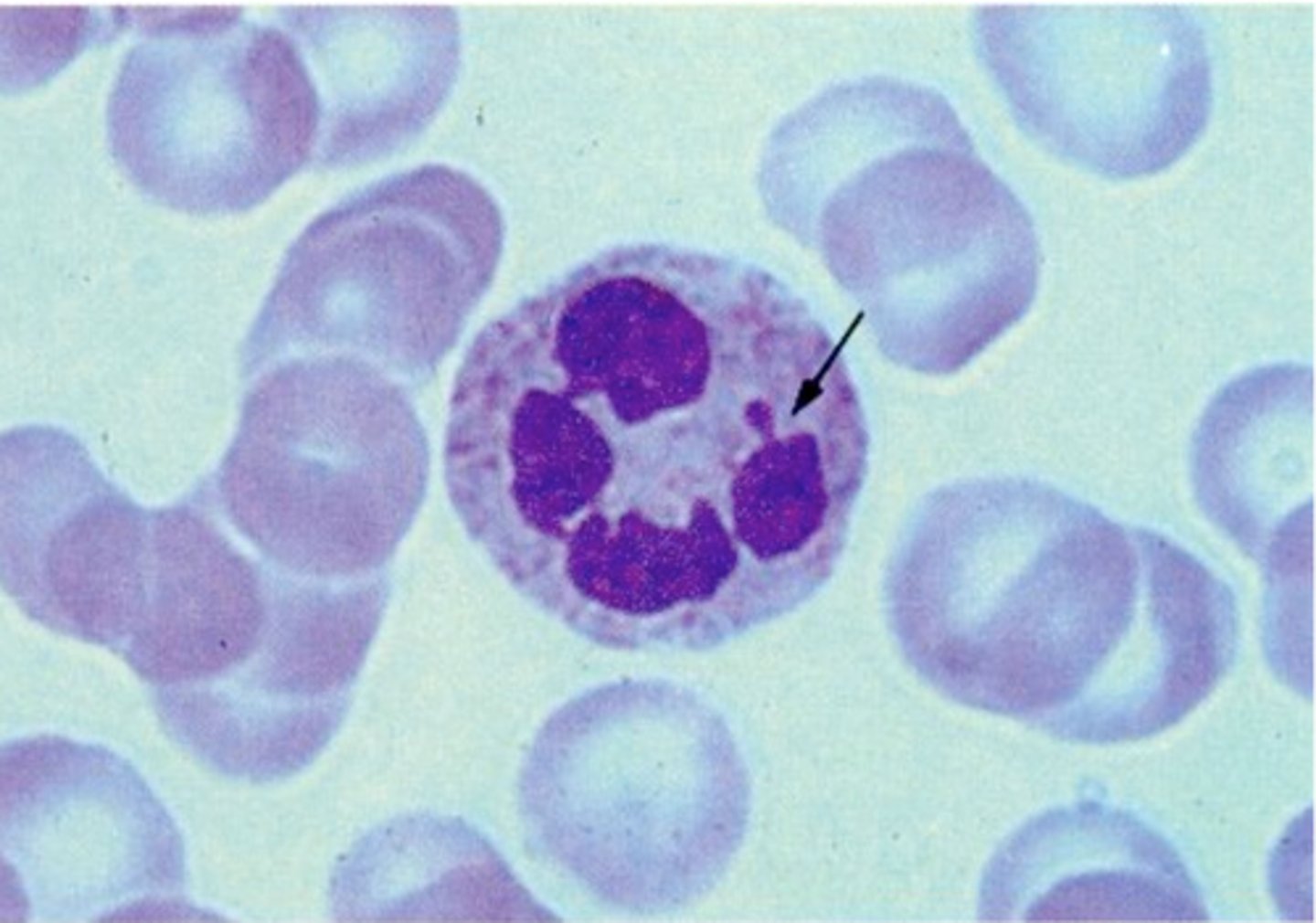 <p>- nejčastější → počet stoupá při infekcích</p><p>- neutrální barviva</p><p>- fagocytóza, diapedéza</p><p>- nespecifickou obranyschopnost</p><p>- jádro rozděleno do několika segmentů</p>