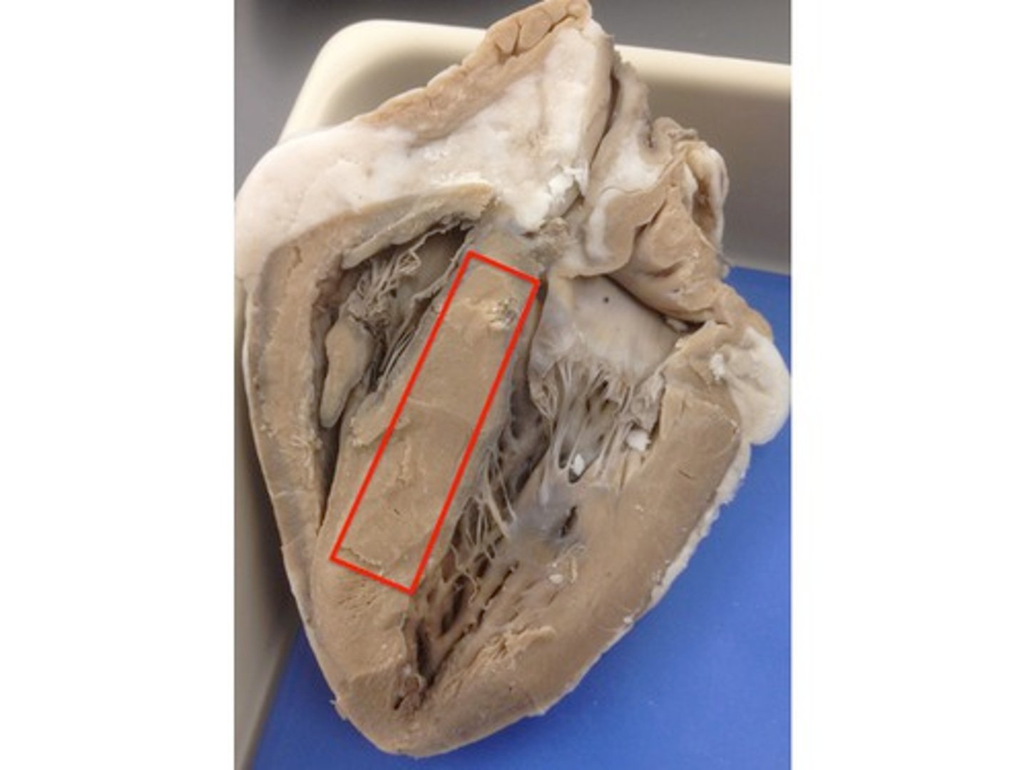 <p>Structure; separates the ventricles, pinch</p><p>H7</p>